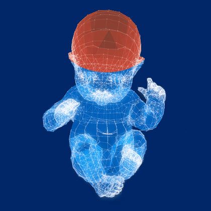 Brain Injury